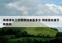 颅骨修补工伤赔偿标准是多少 颅骨修补属于残疾吗